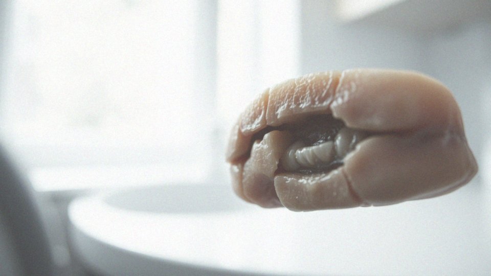 Odsłonięty nerw zęba – przyczyny, objawy i sposoby leczenia